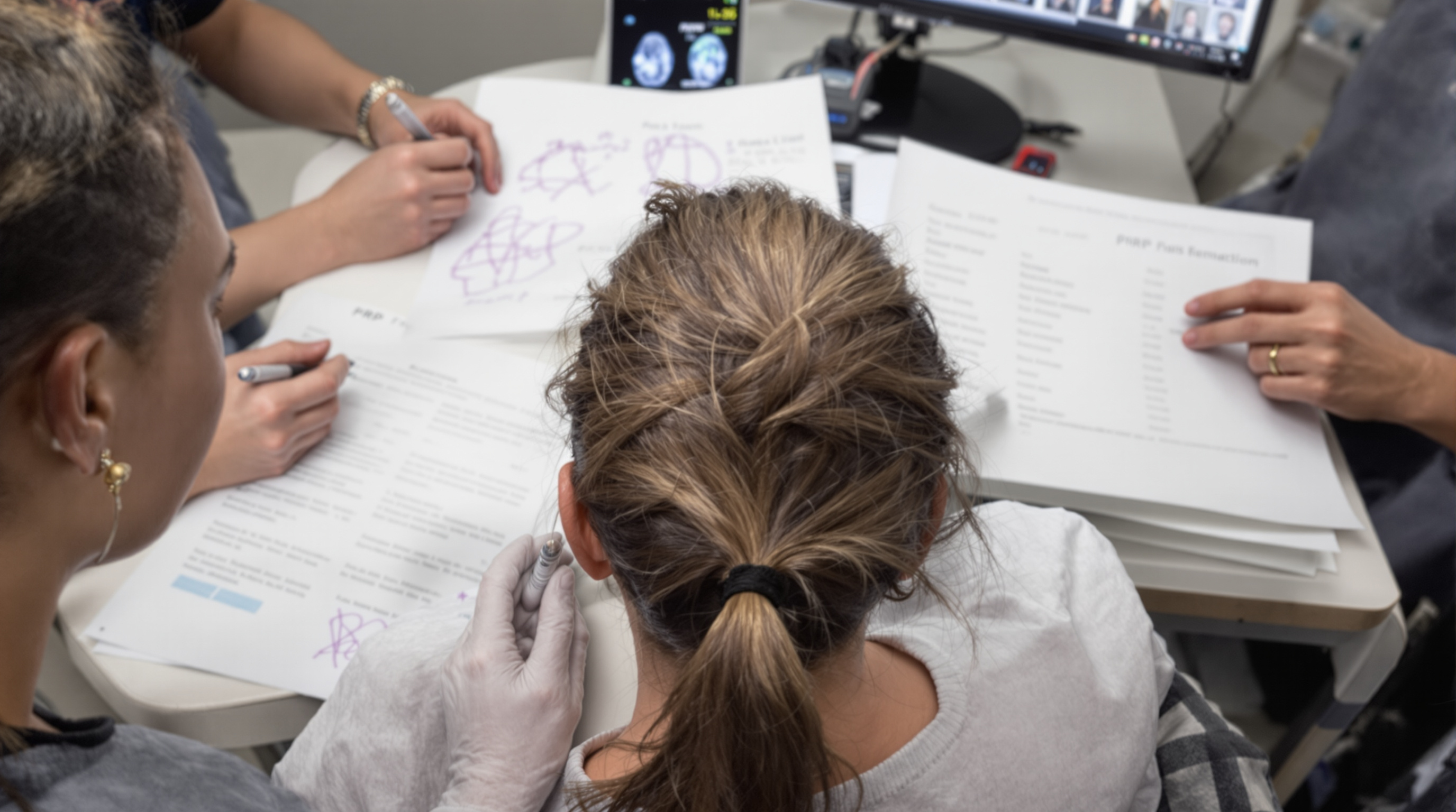 Does PRP work for hair loss? cover